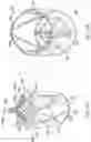 Fig. 38 - APPARATUS AND METHODS FOR TREATING A DEFECTIVE CARDIAC VALVE