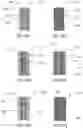 Fig. 45 - APPARATUS AND METHODS FOR TREATING A DEFECTIVE CARDIAC VALVE