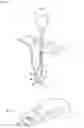 Fig. 02 - Prosthetic system with motorized hydraulic pump designed to control the inflation of an inflatable element
