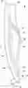 Fig. 01 - Prosthetic implant removal tool and associated method