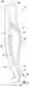 Fig. 03 - Prosthetic implant removal tool and associated method