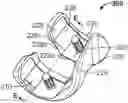 Fig. 01 - Anthropometric posterior condyle