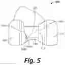 Fig. 06 - Anthropometric posterior condyle