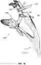 Fig. 09 - GLENOID IMPLANT