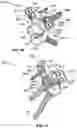 Fig. 27 - GLENOID IMPLANT