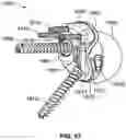 Fig. 44 - GLENOID IMPLANT