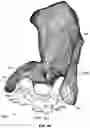 Fig. 75 - GLENOID IMPLANT