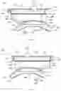 Fig. 33 - IMPLANTS AND METHODS OF USE AND ASSEMBLY
