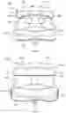 Fig. 47 - IMPLANTS AND METHODS OF USE AND ASSEMBLY