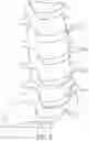Fig. 03 - Expandable intervertebral fusion implant