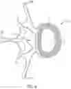 Fig. 05 - Expandable intervertebral fusion implant
