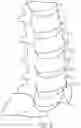 Fig. 03 - Expandable intervertebral fusion implant