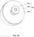 Fig. 03 - Implant guide system for hip replacement surgery