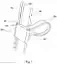 Fig. 05 - Implant guide system for hip replacement surgery