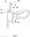 Fig. 06 - Implant guide system for hip replacement surgery