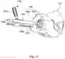 Fig. 13 - Implant guide system for hip replacement surgery