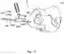 Fig. 15 - Implant guide system for hip replacement surgery