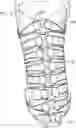 Fig. 01 - Adjustable prosthetic limb system