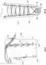 Fig. 13 - Adjustable prosthetic limb system