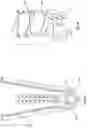Fig. 14 - Adjustable prosthetic limb system