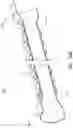 Fig. 10 - Esophageal stents with helical thread