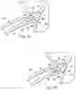 Fig. 09 - Stent delivery under direct visualization
