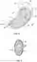 Fig. 08 - METHODS, DEVICES, AND SYSTEMS FOR OBESITY TREATMENT