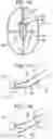 Fig. 09 - METHODS, DEVICES, AND SYSTEMS FOR OBESITY TREATMENT