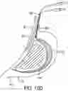 Fig. 12 - METHODS, DEVICES, AND SYSTEMS FOR OBESITY TREATMENT