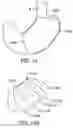 Fig. 15 - METHODS, DEVICES, AND SYSTEMS FOR OBESITY TREATMENT