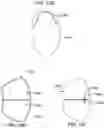 Fig. 17 - METHODS, DEVICES, AND SYSTEMS FOR OBESITY TREATMENT