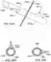 Fig. 19 - METHODS, DEVICES, AND SYSTEMS FOR OBESITY TREATMENT
