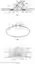 Fig. 04 - EASILY FORMED ARM EXTERNAL FIXING BRACE