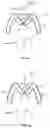 Fig. 05 - Methods and devices to prevent premature birth, stillbirth, miscarriage, infection, or pregnancy