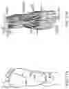 Fig. 18 - Methods, systems, and devices for treating nerve spasticity