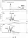 Fig. 08 - EXTERNAL AND INTERNAL INTRAOPERATIVE OPTICAL COHERENCE TOMOGRAPHY IMAGING FOR SUBRETINAL MATERIAL DELIVERY