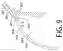 Fig. 10 - IMPLANTABLE OCULAR DRUG DELIVERY DEVICES AND METHODS