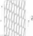 Fig. 03 - METHOD AND DEVICE FOR TREATING EYE DISEASE