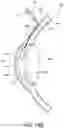 Fig. 18 - METHOD AND DEVICE FOR TREATING EYE DISEASE