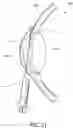 Fig. 23 - METHOD AND DEVICE FOR TREATING EYE DISEASE