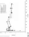Fig. 26 - METHOD AND DEVICE FOR TREATING EYE DISEASE