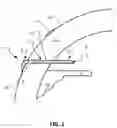 Fig. 02 - GLAUCOMA TREATMENT DEVICES AND METHODS
