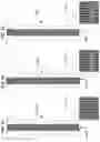 Fig. 11 - GLAUCOMA TREATMENT DEVICES AND METHODS