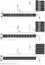 Fig. 12 - GLAUCOMA TREATMENT DEVICES AND METHODS