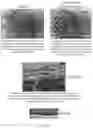 Fig. 08 - SYSTEMS AND METHODS FOR OCULAR LASER SURGERY AND THERAPEUTIC TREATMENTS