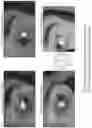 Fig. 108 - SYSTEMS AND METHODS FOR OCULAR LASER SURGERY AND THERAPEUTIC TREATMENTS