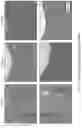 Fig. 124 - SYSTEMS AND METHODS FOR OCULAR LASER SURGERY AND THERAPEUTIC TREATMENTS