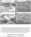 Fig. 149 - SYSTEMS AND METHODS FOR OCULAR LASER SURGERY AND THERAPEUTIC TREATMENTS