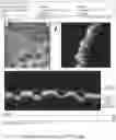 Fig. 48 - SYSTEMS AND METHODS FOR OCULAR LASER SURGERY AND THERAPEUTIC TREATMENTS