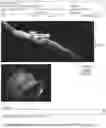 Fig. 52 - SYSTEMS AND METHODS FOR OCULAR LASER SURGERY AND THERAPEUTIC TREATMENTS